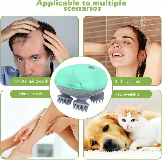 Scalp Head Massager | Electric Head & Body Massager – স্ক্যাল্প, মাথা ও শরীরের ম্যাসাজার 3