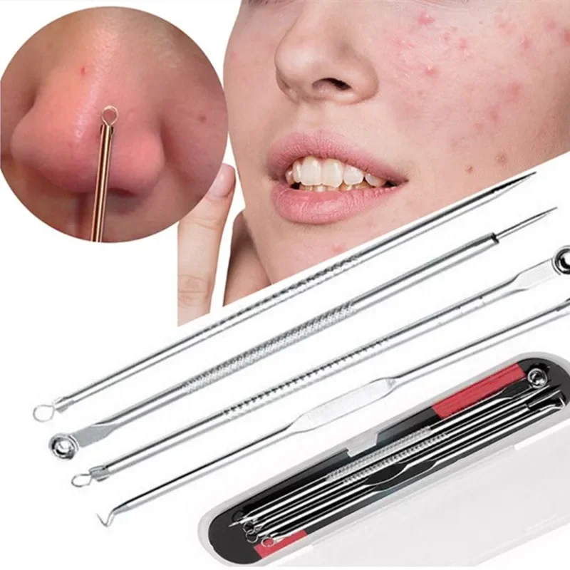 Blackhead Tweezers and Whitehead Remover Tool Spot Treatment Acne Set, Pimple Extractor Tool, ব্ল্যাকহেড টুইজার এবং হোয়াইটহেড রিমুভার টুল স্পট ট্রিটমেন্ট ব্রণ সেট, পিম্পল এক্সট্র্যাক্টর টুল